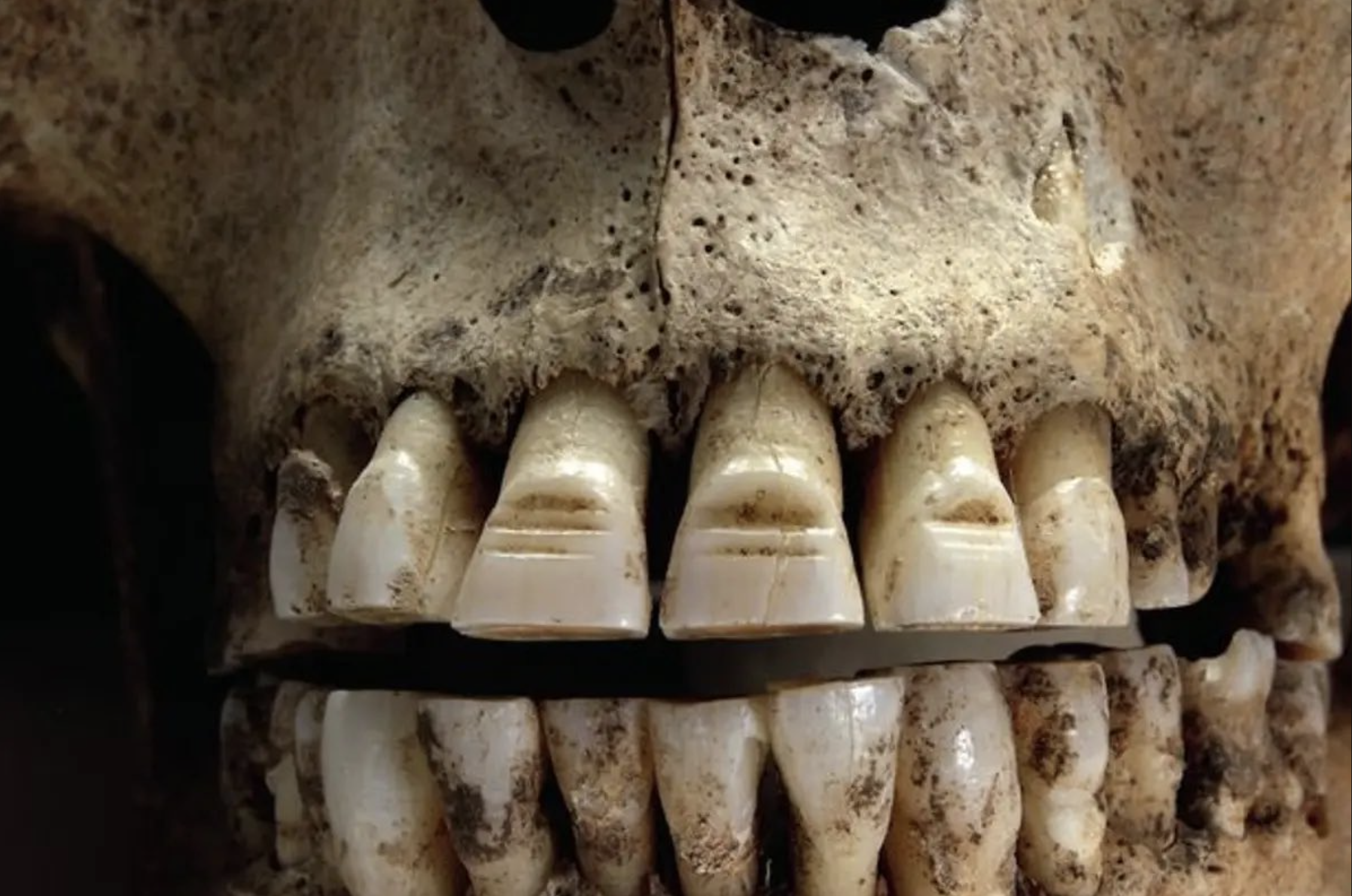 vikings dents